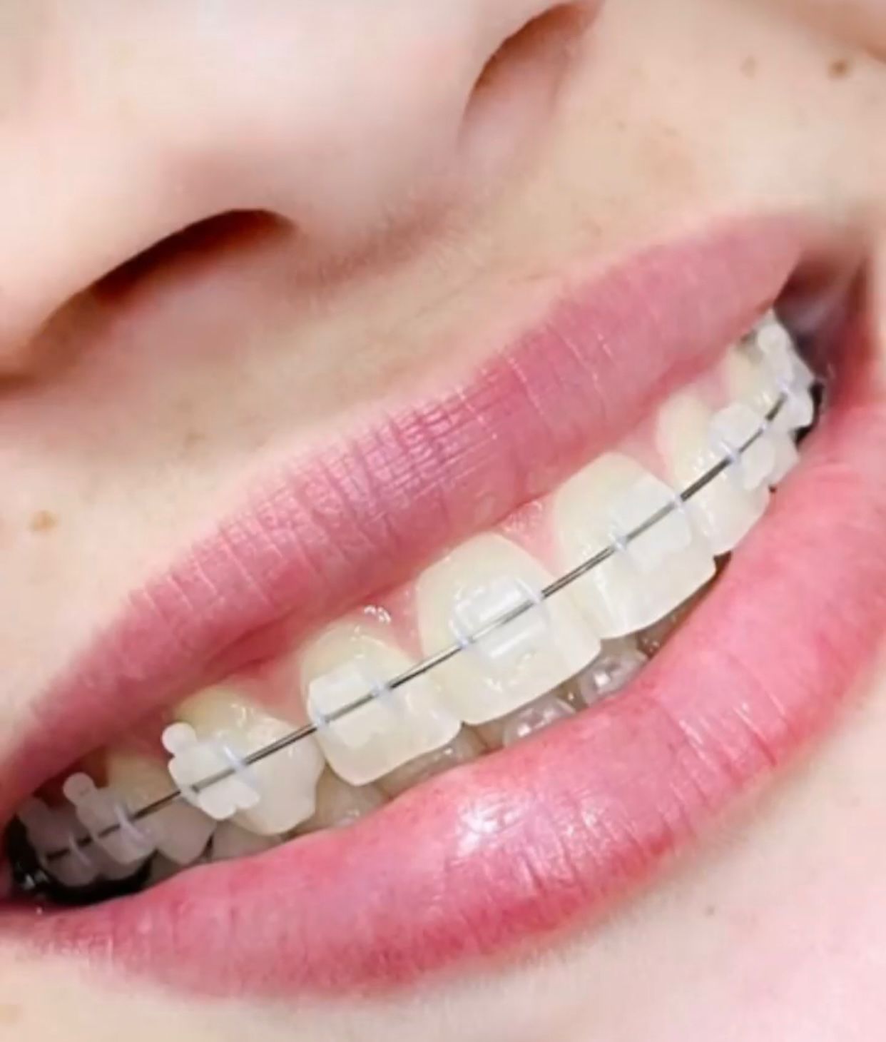 Aparelhos Estéticos - Clínica DYVARE Içara